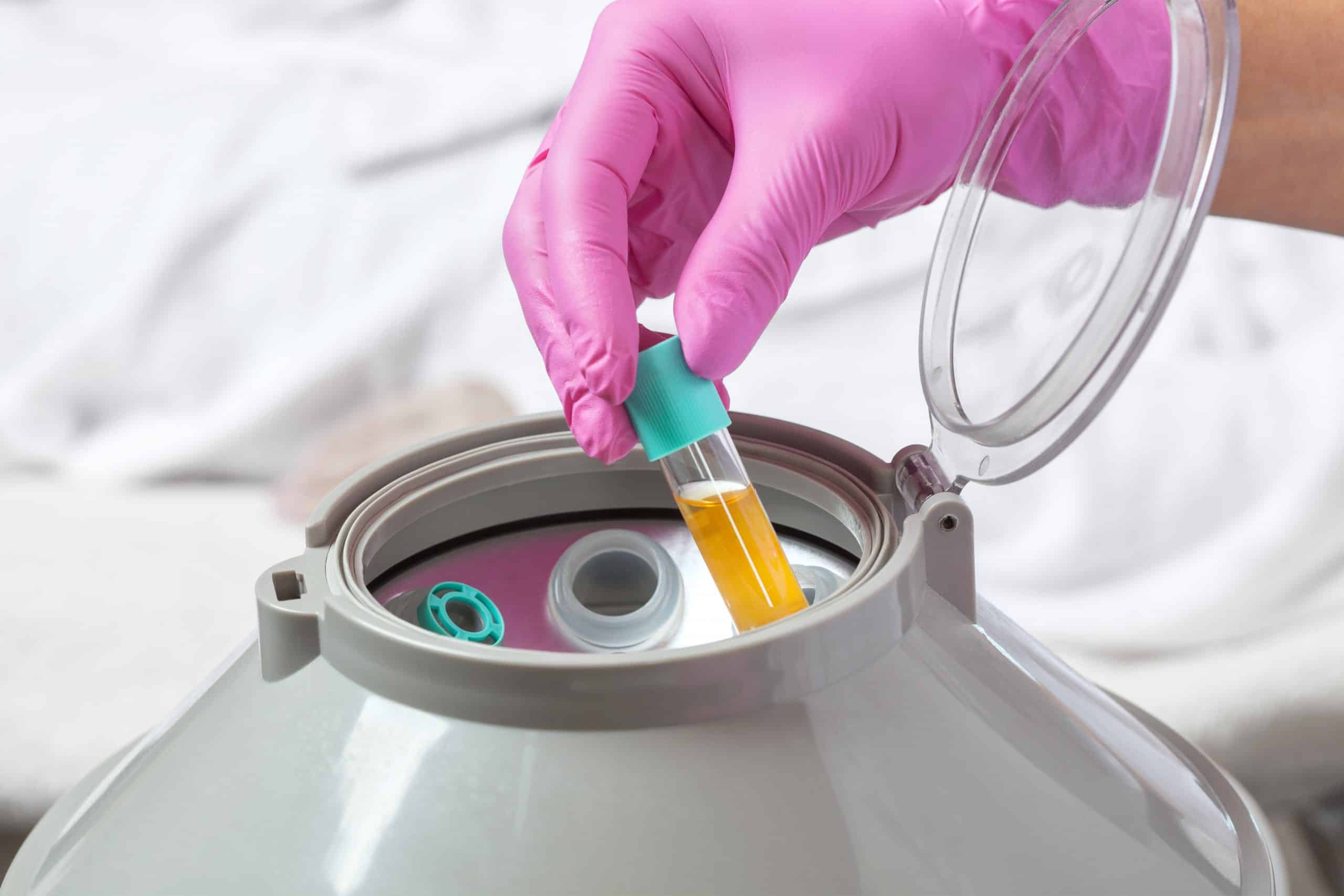 הצערת פנים באמצעות תאי גזע