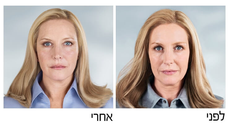 סקולפטרה לפני אחרי (1)